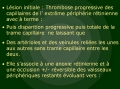 DREPANOCYTOSE - Dr Gérard ROYER