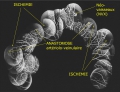 DREPANOCYTOSE - Dr Gérard ROYER