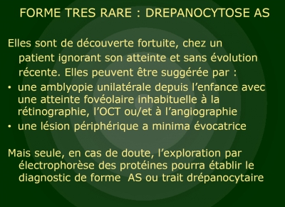 DREPANOCYTOSE - Dr Gérard ROYER
