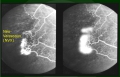 DREPANOCYTOSE - Dr Gérard ROYER